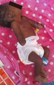 GALAMSEY AND ABNORMAL BABIES