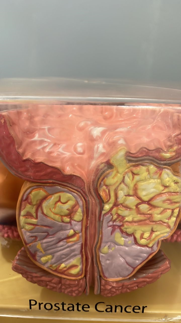 PROSTATE CANCER IN 97-YEAR PATIENT